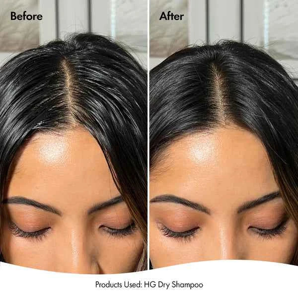 Bondi Boost Hair Growth Dry Shampoo - Image 3